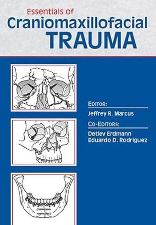download Essentials of Craniomaxillofacial Trauma